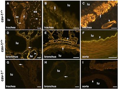 Caveolin-1: Functional Insights into Its Role in Muscarine- and Serotonin-Induced Smooth Muscle Constriction in Murine Airways